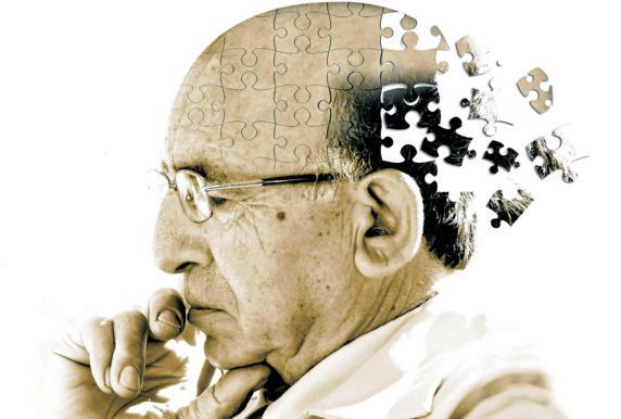 Alzheimer