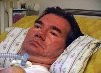 Piergiorgio-Welby.jpg